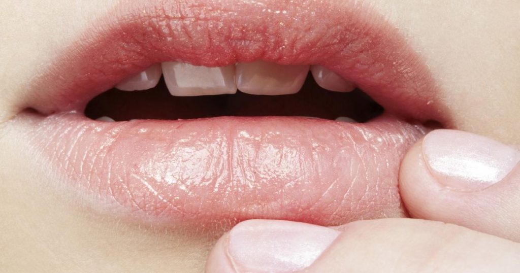 what causes dry mouth