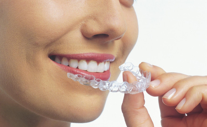 Invisalign: the barely there brace