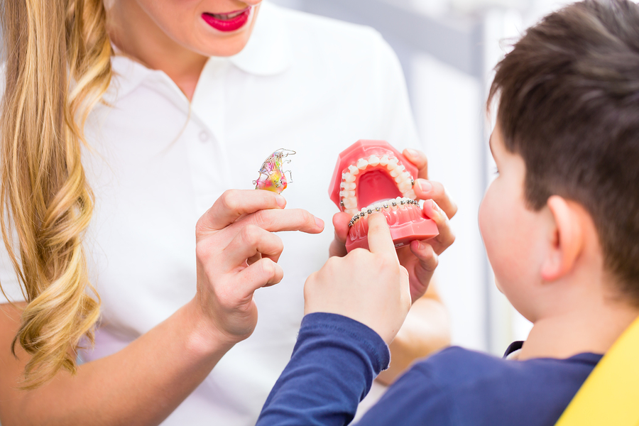 what to know about getting braces