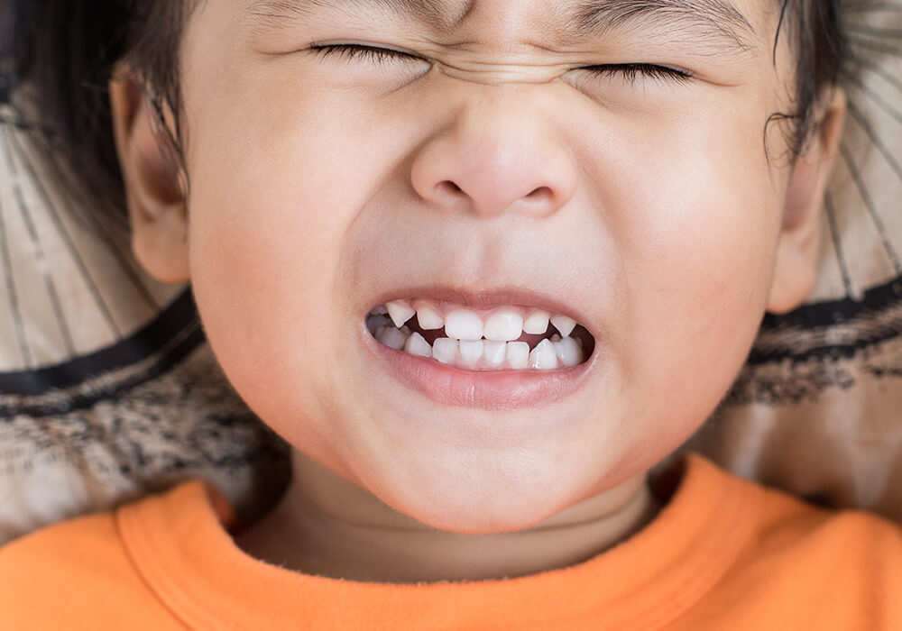 teeth grinding in children, bruxism in children, bruxism in kids